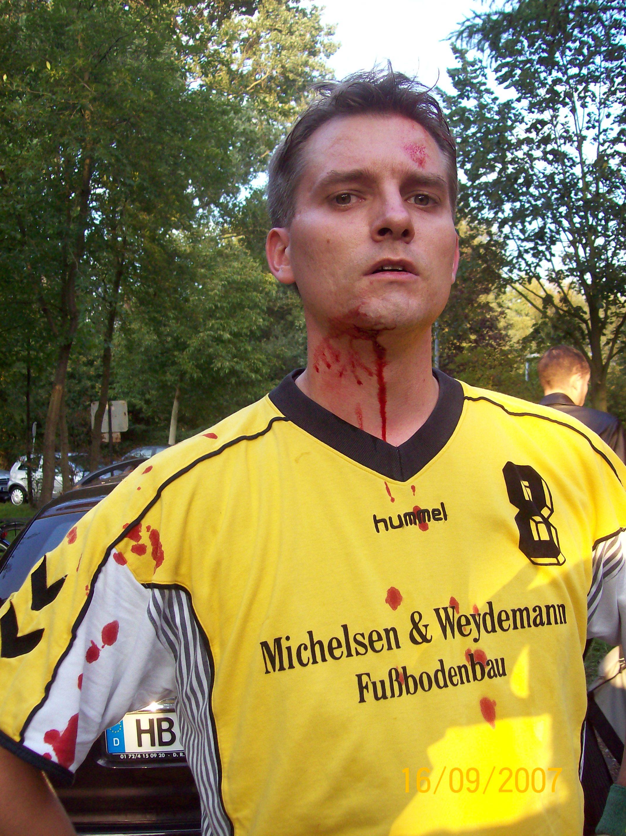 Platzwunde